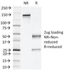 SDS-PAGE analysis of Anti-NAPSIN A Antibody [NAPSA/1239] under non-reduced and reduced conditions; showing intact IgG and intact heavy and light chains, respectively. SDS-PAGE analysis confirms the integrity and purity of the Antibody