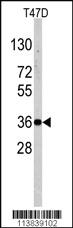 Anti-NANOS1 Rabbit Polyclonal Antibody