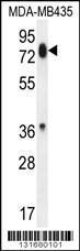 Anti-PCDHB13 Rabbit Polyclonal Antibody (Biotin)