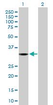 Anti-ROM1 Mouse Polyclonal Antibody