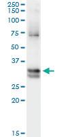 Anti-NIT1 Mouse Monoclonal Antibody