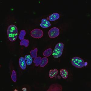 High magnification confocal immunofluorescence image of Anti-Ki67 Antibody stained HeLa cells grown in tissue culture (green)