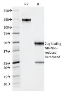 SDS-PAGE analysis of Anti-Thyroid Peroxidase Antibody [TPO/1922] under non-reduced and reduced conditions; showing intact IgG and intact heavy and light chains, respectively. SDS-PAGE analysis confirms the integrity and purity of the antibody.