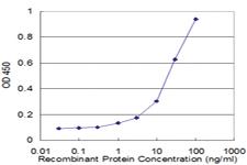 Anti-RBP3 Mouse Monoclonal Antibody [clone: 4F3]