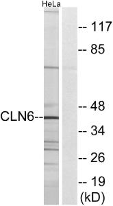 Western blot analysis of lysates from HeLa cells using Anti-CLN6 Antibody The right hand lane represents a negative control, where the antibody is blocked by the immunising peptide