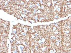 Immunohistochemical analysis of formalin-fixed, paraffin-embedded human brain using Anti-Myelin Basic Protein Antibody [MBP/4273]