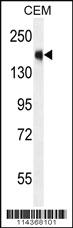 Anti-SRC Rabbit Polyclonal Antibody