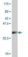 Anti-CACNA1S Mouse Polyclonal Antibody