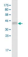 Anti-RABGAP1 Mouse Monoclonal Antibody [clone: 3D11]