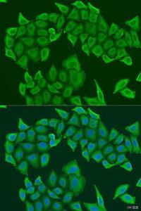 Immunofluorescence analysis of U2OS cells using Anti-NYS48 Antibody (A10238) at a dilution of 1:100. DAPI was used to stain the cell nuclei (blue)