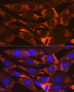 Immunofluorescence analysis of NIH-3T3 cells using Anti-G3BP Antibody [ARC0875] (A305824) at a dilution of 1:100 (40X lens). DAPI was used to stain the cell nuclei (blue)