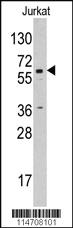 Anti-CYP19A1 Rabbit Polyclonal Antibody