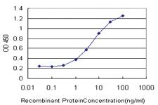 Anti-ERN1 Mouse Monoclonal Antibody [clone: 5F3]