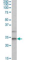 Anti-MAD2L1 Goat Polyclonal Antibody