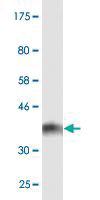 Anti-CYTH2 Mouse Monoclonal Antibody [clone: 5E11]