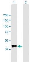 Anti-CPB1 Mouse Polyclonal Antibody