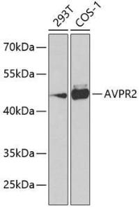 Western blot analysis of extracts of various cell lines, using Anti-V2R Antibody (A10242) at 1:1,000 dilution The secondary antibody was Goat Anti-Rabbit IgG H&L Antibody (HRP) at 1:10,000 dilution Lysates/proteins were present at 25 µg per lane