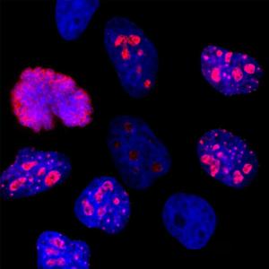 Immunofluorescent analysis of HeLa cells stained with Anti-Ki67 Antibody (1:2000 / red)