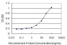 Anti-ERN1 Mouse Monoclonal Antibody [clone: 6G11]