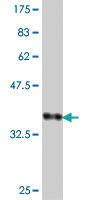 Anti-MCCC2 Mouse Polyclonal Antibody