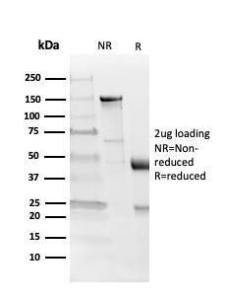 SDS-PAGE analysis of Anti-Myelin Basic Protein Antibody [MBP/4273] under non-reduced and reduced conditions; showing intact IgG and intact heavy and light chains, respectively. SDS-PAGE analysis confirms the integrity and purity of the antibody.