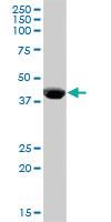 Anti-CPB1 Mouse Polyclonal Antibody