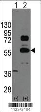 Anti-SOX9 Rabbit Polyclonal Antibody