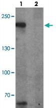 Anti-TET3 Rabbit Polyclonal Antibody