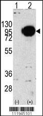 Anti-Glycogen Phosphorylase, Muscle Form Rabbit Polyclonal Antibody (HRP (Horseradish Peroxidase))