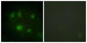 Immunofluorescence analysis of HeLa cells using Anti-DDX5 Antibody. The right hand panel represents a negative control, where the antibody was pre-incubated with the immunising peptide.