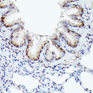 Anti-Cdk4 antibody