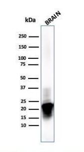 Western blot analysis of human brain tissue lysate using Anti-Myelin Basic Protein Antibody [MBP/4273]