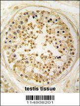 Anti-SFPQ Rabbit Polyclonal Antibody