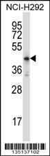 Anti-HOXD10 Rabbit Polyclonal Antibody (AP (Alkaline Phosphatase))