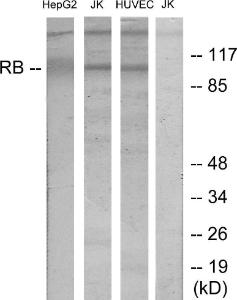 Western blot analysis of lysates from HepG Jurkat, and HUVEC cells using Anti-Retinoblastoma Antibody The right hand lane represents a negative control, where the antibody is blocked by the immunising peptide