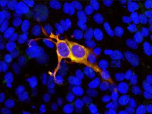 Anti-CRISPR-Cas9 Rabbit Polyclonal Antibody