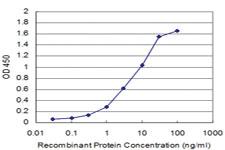 Anti-BRD3 Mouse Monoclonal Antibody [clone: 6E7]