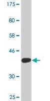 Anti-NEK4 Mouse Monoclonal Antibody [clone: 1B8]