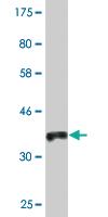 Anti-MCCC2 Mouse Monoclonal Antibody [clone: 2B3]