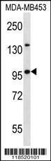 Anti-NUP88 Rabbit Polyclonal Antibody (FITC (Fluorescein Isothiocyanate))