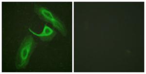 Immunofluorescence analysis of HeLa cells using Anti-CD18 Antibody. The right hand panel represents a negative control, where the antibody was pre-incubated with the immunising peptide