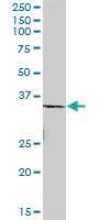 Anti-ROM1 Mouse Polyclonal Antibody