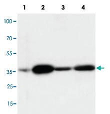 Anti-ANXA2 Rabbit Polyclonal Antibody