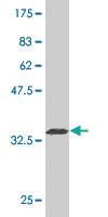 Anti-SEPT9 Mouse Monoclonal Antibody [clone: 2C6]