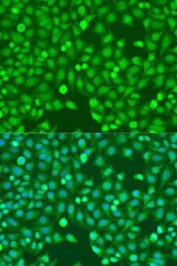 Antibody anti-MEF2A 100 µl