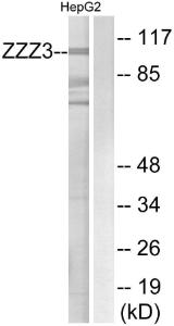 Western blot analysis of lysates from HepG2 cells using Anti-ZZZ3 Antibody. The right hand lane represents a negative control, where the antibody is blocked by the immunising peptide.