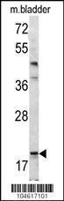 Anti-BAD Rabbit polyclonal antibody unconjugated