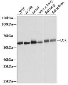 Western blot analysis of extracts of various cell lines, using Anti-LOX Antibody [ARC0624] (A81177) at 1:1000 dilution. The secondary Antibody was Goat Anti-Rabbit IgG H&L Antibody (HRP) at 1:10000 dilution. Lysates/proteins were present at 25 µg per lane