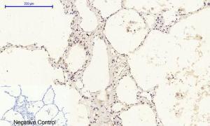 Immunohistochemical analysis of paraffin-embedded human lung tissue using Anti-Retinoblastoma Antibody at 1:200 (4°C overnight) Negative control was secondary antibody only