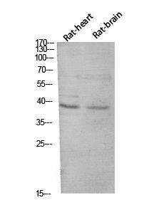 Anti-CER1 antibody